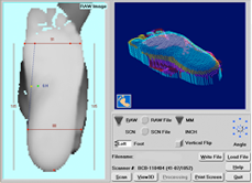 3D Laser Casting for Custom Orthotics