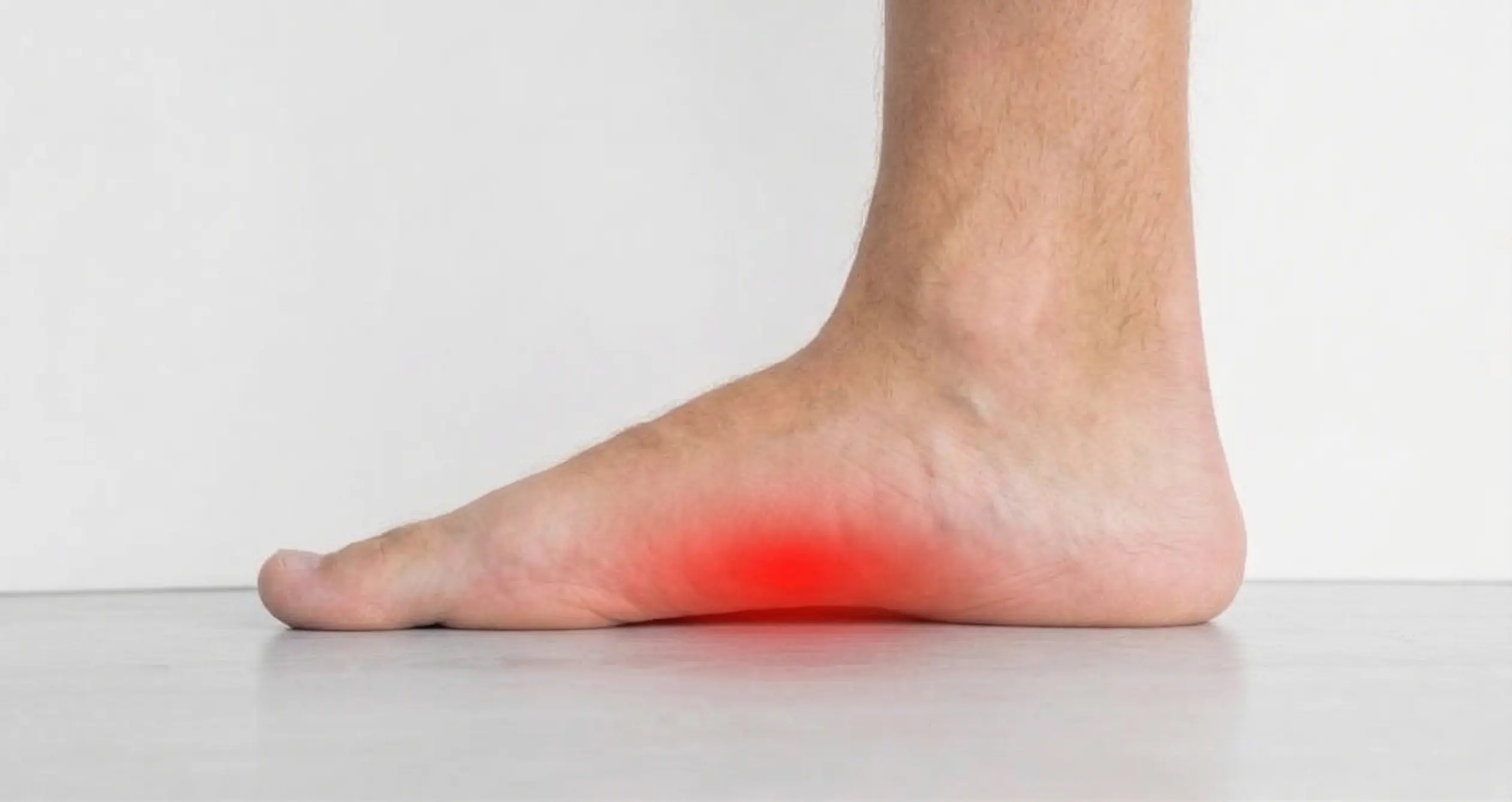 Flat Feet (Pes Planus)